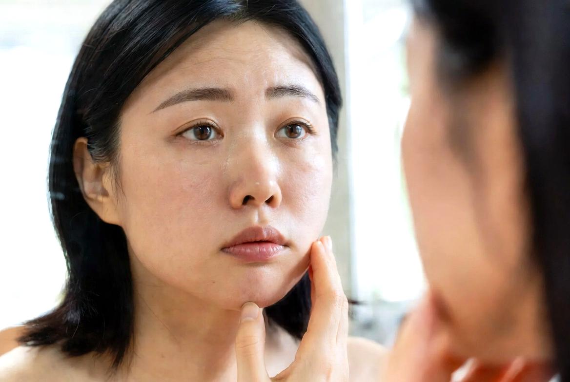 アゼライン酸が毛穴と皮脂バランスに働きかける美容成分として紹介されるイメージ