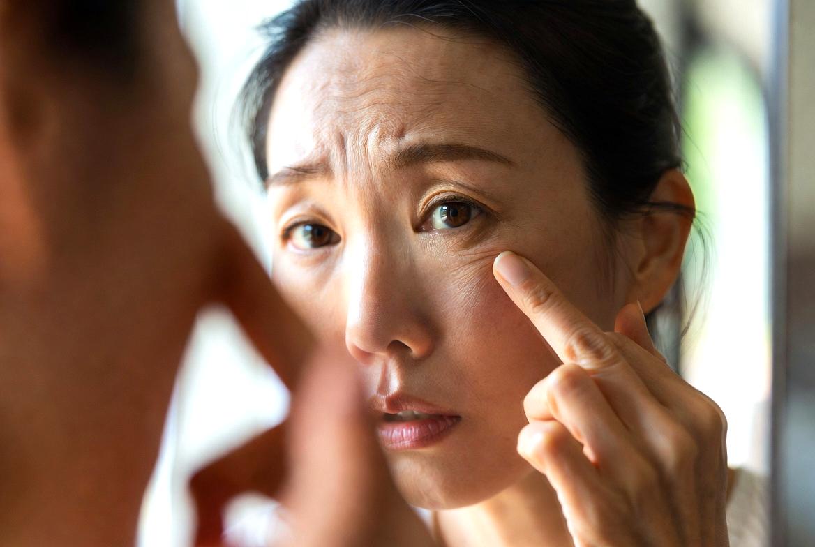 アゼライン酸使用時の注意点をやさしく伝えるイメージ