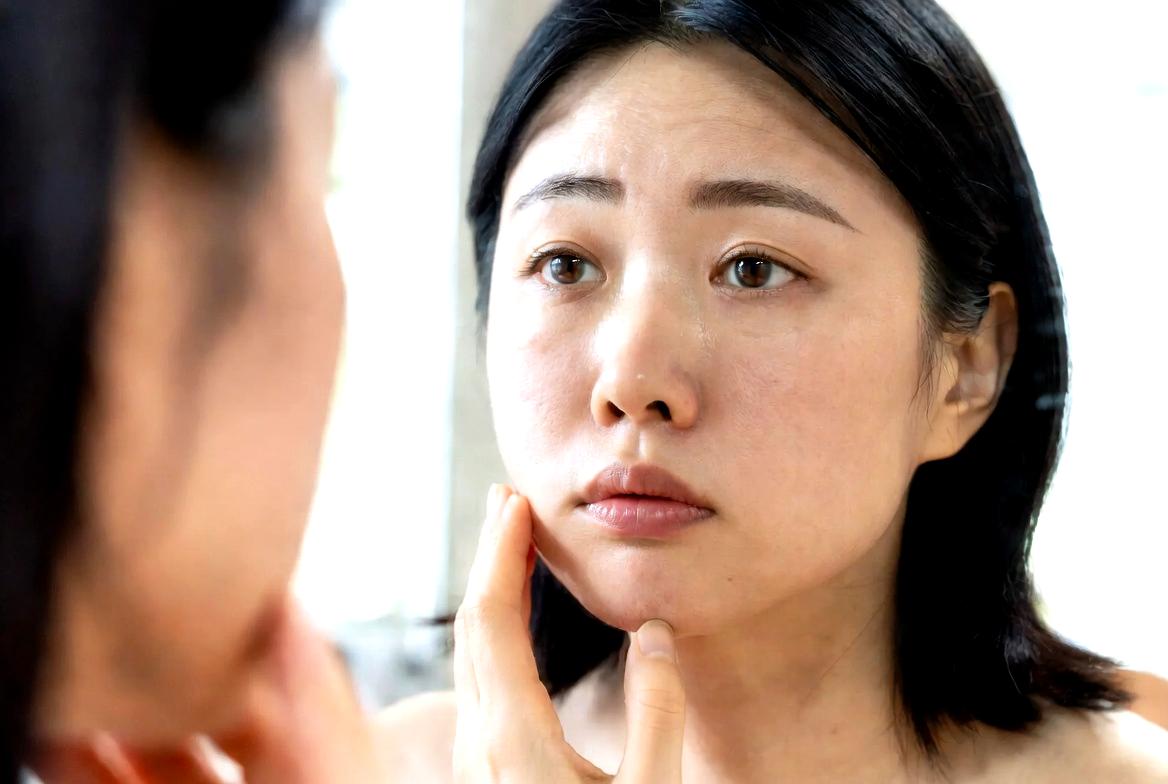 ドクダミ茶で肌荒れやニキビをケアするイメージ