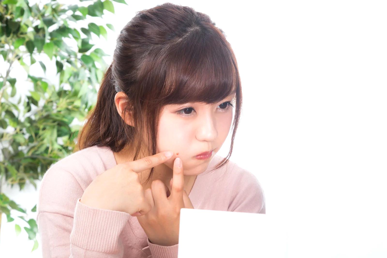 ニキビ肌と皮脂の悩みを抱えた女性のスキンケアイメージ