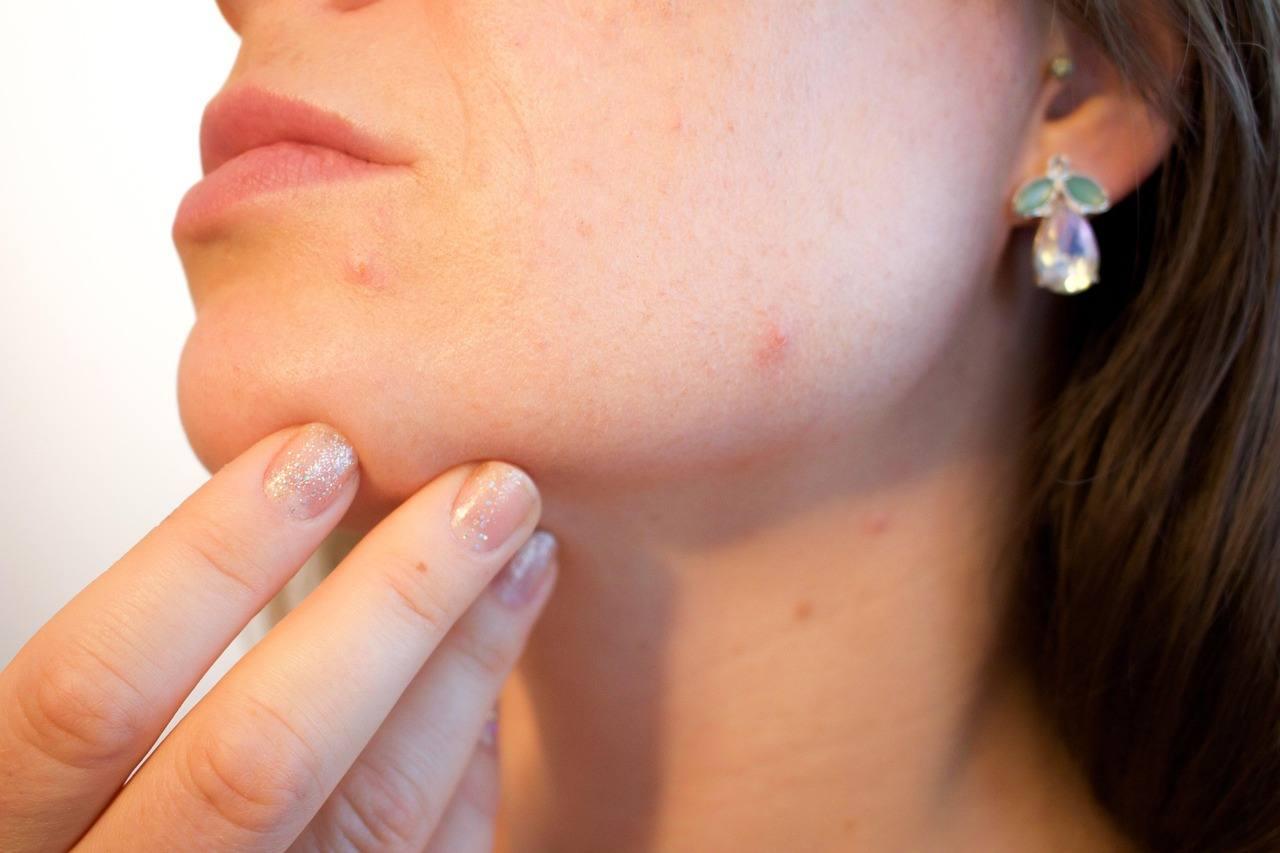 肌トラブルを防ぐために注意する女性のスキンケア