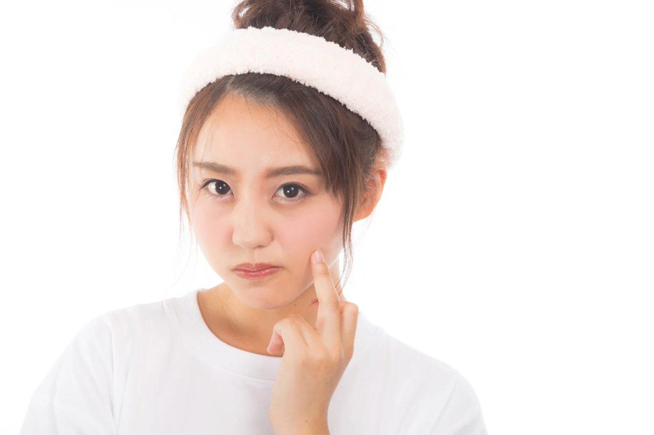 ニキビ肌向けミスト化粧水の選び方